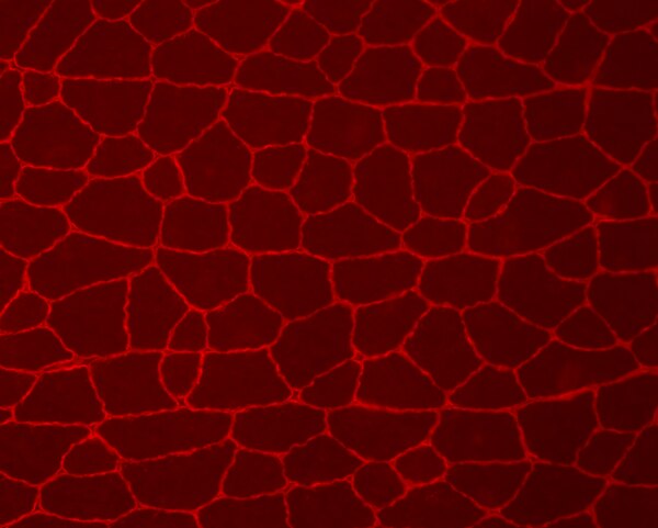 Immunohistochemistry (IHC) image of wild-type mouse gastrocnemius muscle sections labeled with DSHB anti-dystrophin [6A9]. PMID: 39034316, Fig. 3B